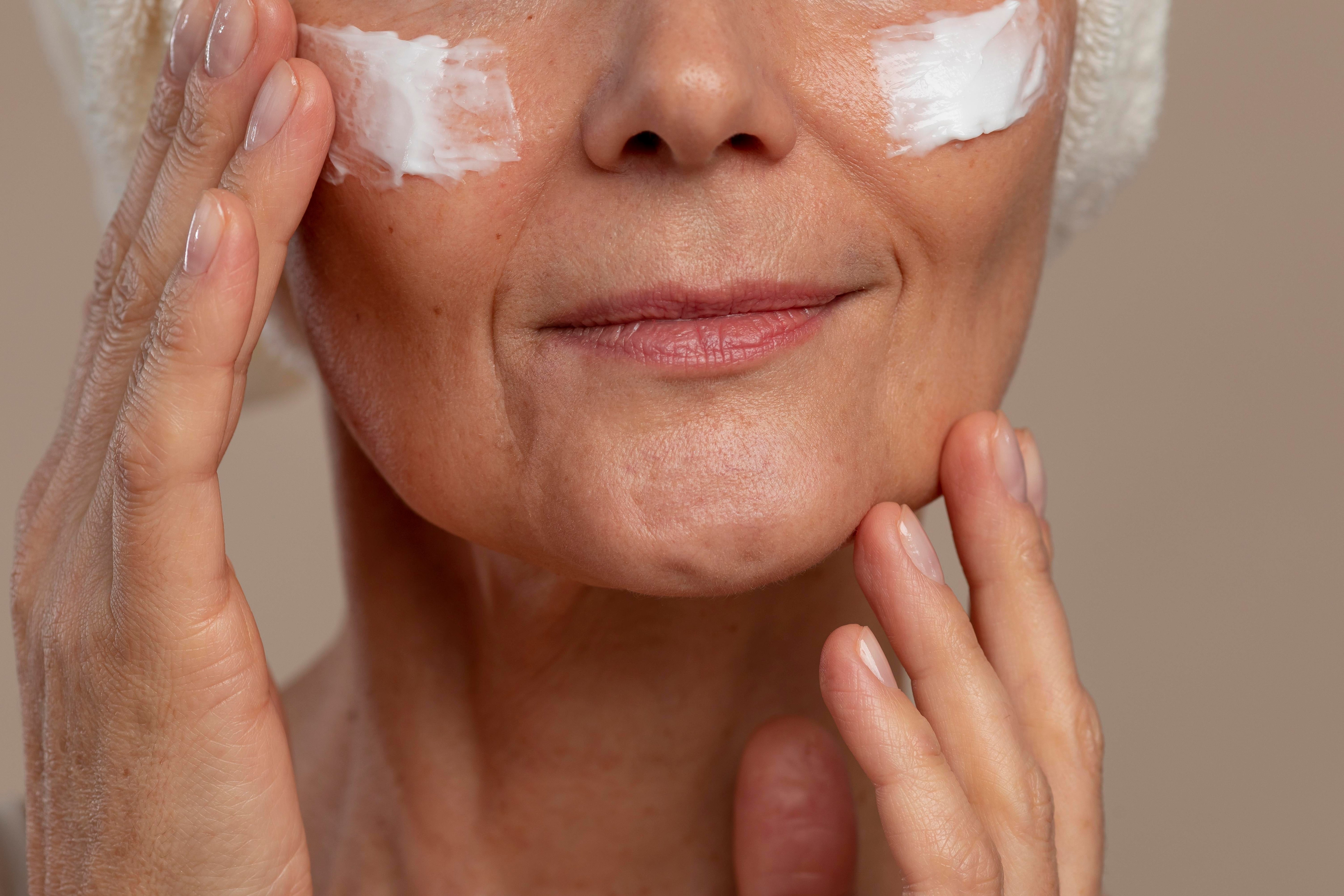 Taches hormonales au visage : comprendre, prévenir et traiter naturellement