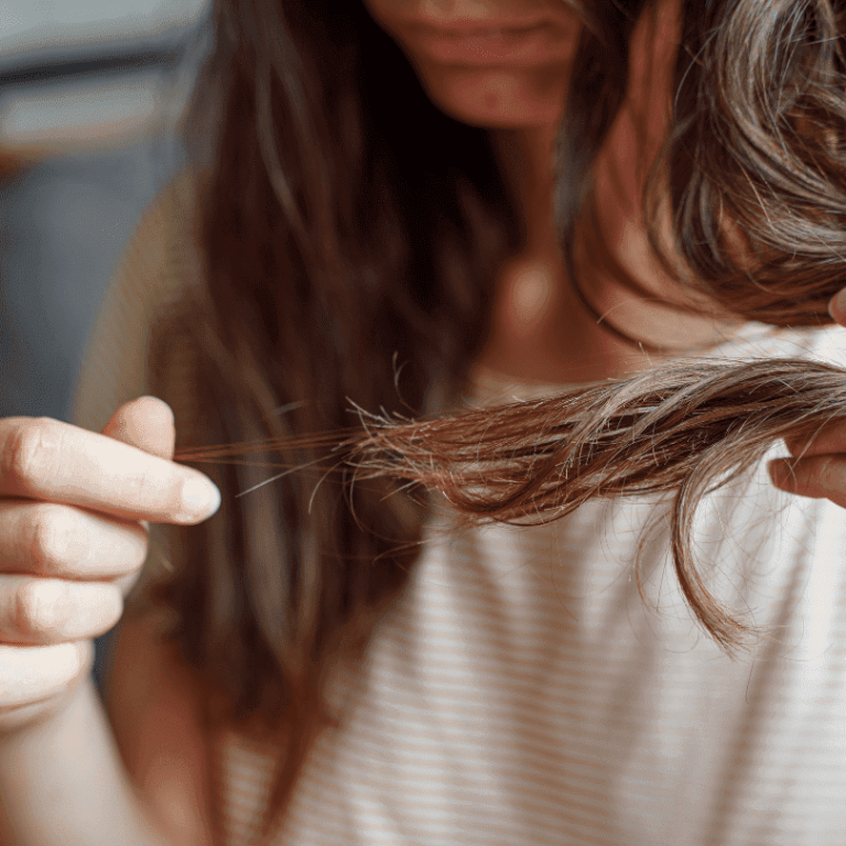 perte de cheveux