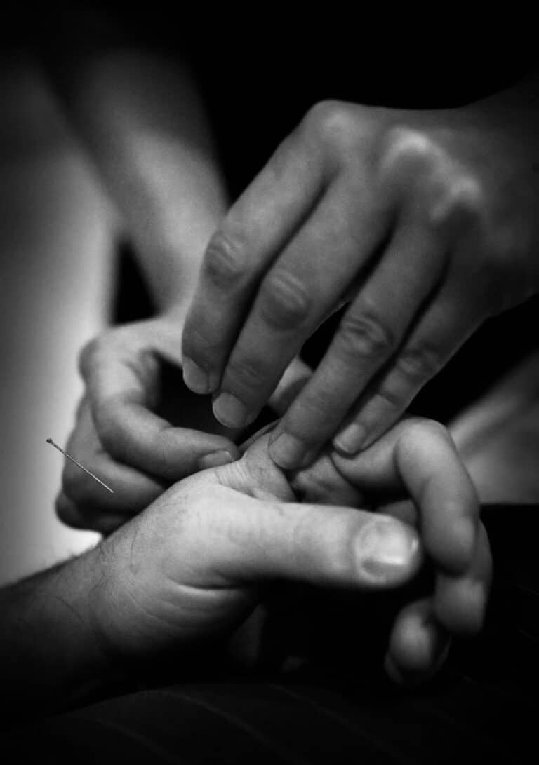 séance d'acupuncture