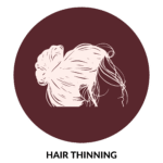 Hair thinning