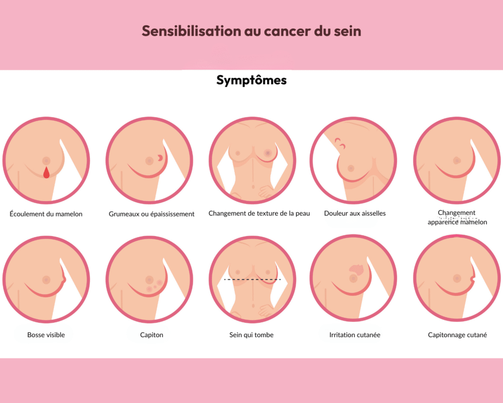 palpation mammaire