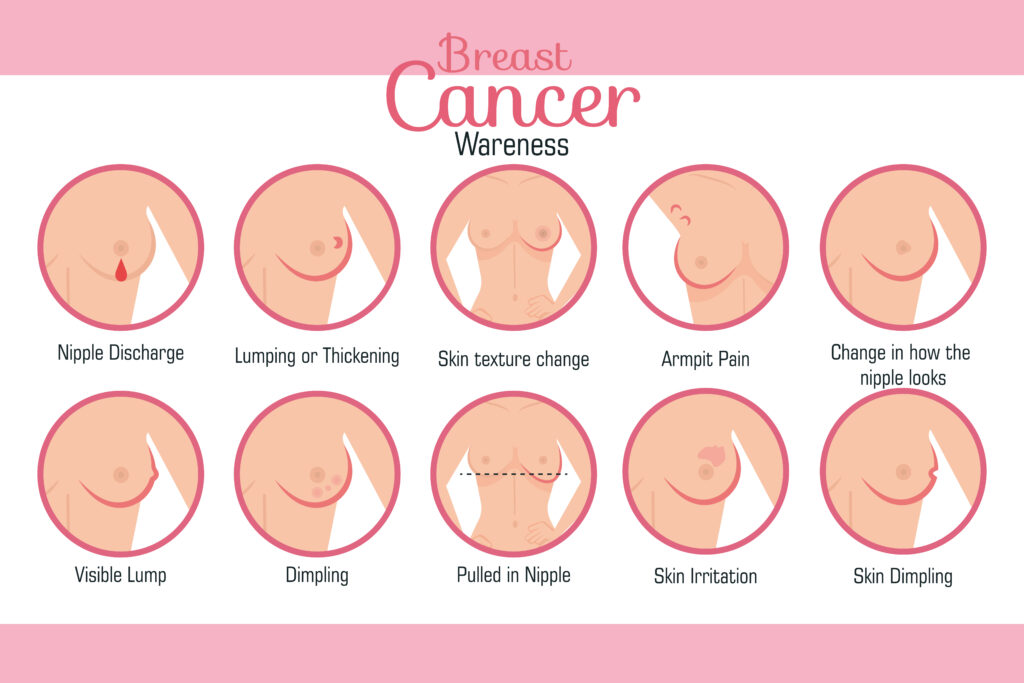 sel breast exam