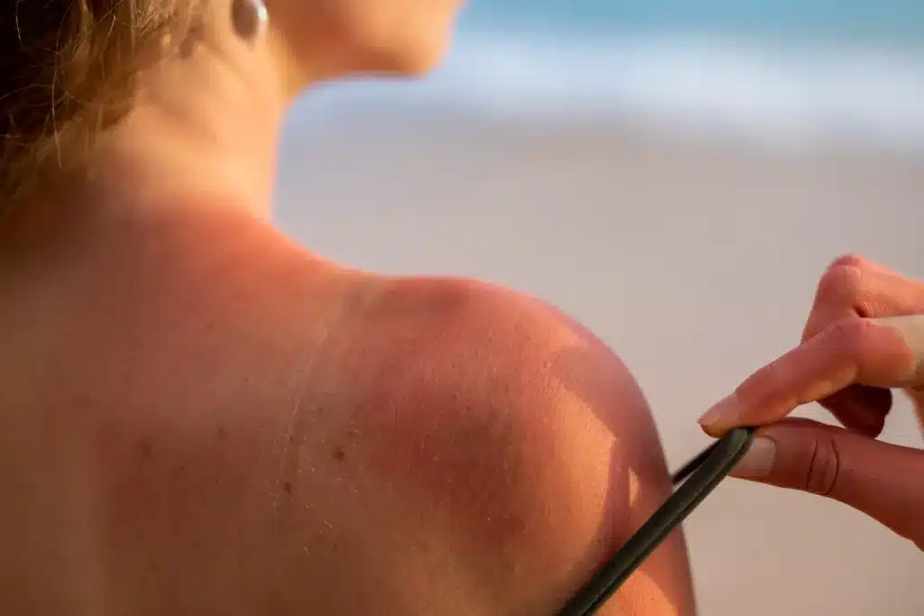 sunscreen application